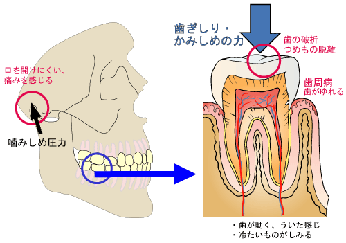 イメージ画像